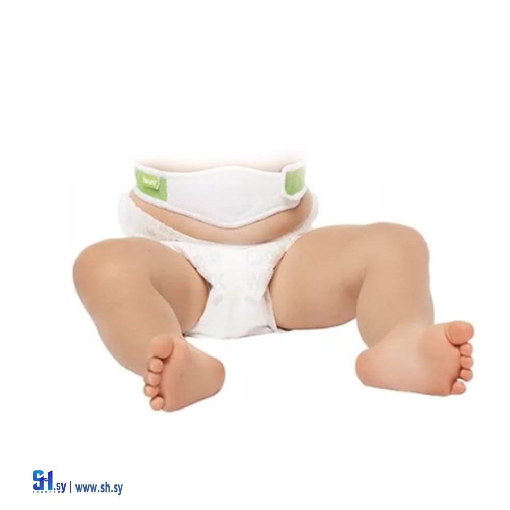 فتق صرة أطفال (شام شفا)